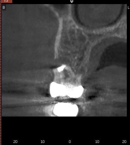 CBCT planning scan used in the case selection module